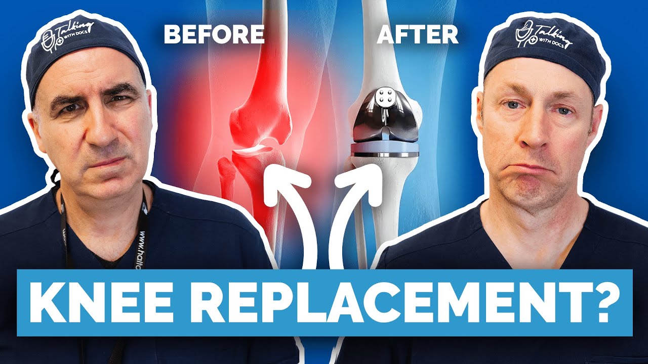 Talking With Docs — What Actually Happens During a Knee Replacement